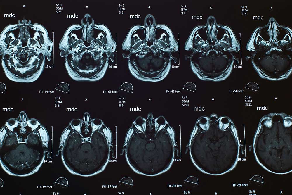 why are cat scans so expensive